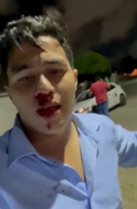 Repórter do Via Certa Natal é agredido durante reportagem