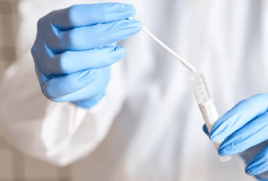 Casos de Covid 19 no RN diminuíram mas muitos ainda morrem