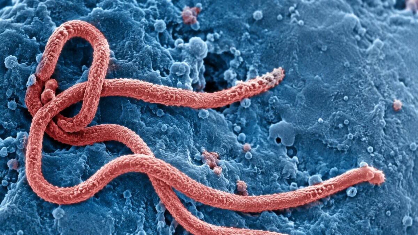 Avanço do Ebola na África coloca 10 países em alerta e mantém vigilância internacional; entenda o risco de chegar ao Brasil